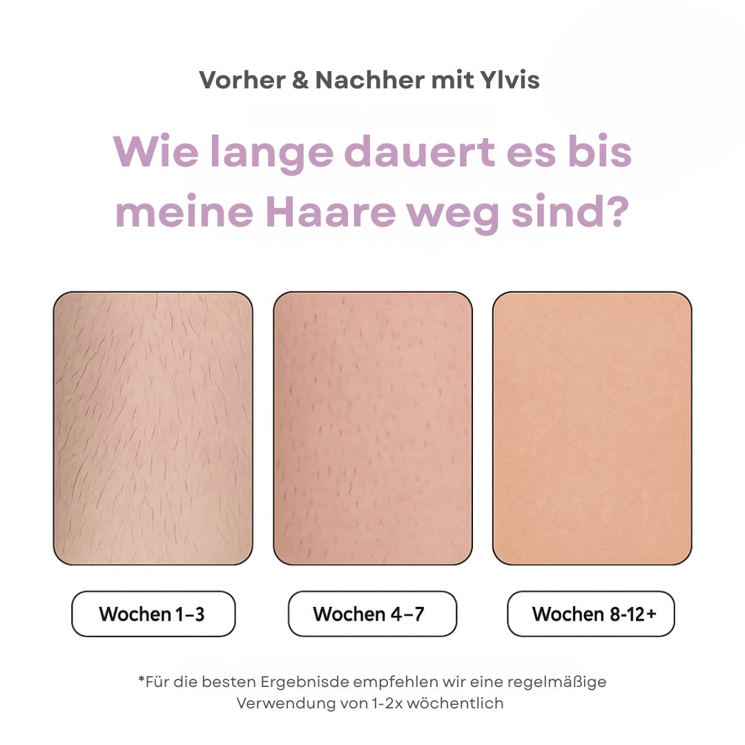 Ylvis IPL Hair Remover I Die führende Laser-Haar-Entfernung für Zuhause